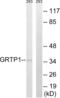 Growth Hormone Regulated TBC Protein 1 antibody, abx014501, Abbexa, Western Blot image 