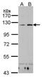 CD11C antibody, PA5-21445, Invitrogen Antibodies, Western Blot image 