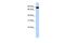 Activating Transcription Factor 6 Beta antibody, PA5-40399, Invitrogen Antibodies, Western Blot image 