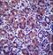 Ankyrin Repeat Domain 22 antibody, LS-C156345, Lifespan Biosciences, Immunohistochemistry paraffin image 