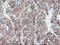 Ribophorin I antibody, LS-C173358, Lifespan Biosciences, Immunohistochemistry paraffin image 