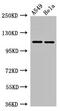 EPH Receptor A5 antibody, CSB-PA007725LA01HU, Cusabio, Western Blot image 