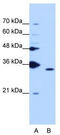 Peptidylprolyl Isomerase E antibody, TA345947, Origene, Western Blot image 