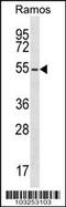 Protein Kinase CAMP-Dependent Type II Regulatory Subunit Beta antibody, 62-622, ProSci, Western Blot image 