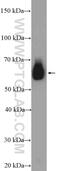 DEAD-Box Helicase 3 X-Linked antibody, 11115-1-AP, Proteintech Group, Western Blot image 