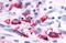 Adhesion G Protein-Coupled Receptor F5 antibody, MBS244341, MyBioSource, Immunohistochemistry paraffin image 