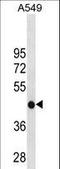 Glycine Amidinotransferase antibody, LS-C157765, Lifespan Biosciences, Western Blot image 