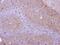 Protein Phosphatase 6 Catalytic Subunit antibody, PA5-28919, Invitrogen Antibodies, Immunohistochemistry frozen image 