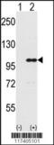 Inositol Polyphosphate-5-Phosphatase D antibody, 61-547, ProSci, Western Blot image 