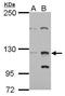 Zinc Finger And AT-Hook Domain Containing antibody, GTX122715, GeneTex, Western Blot image 
