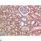 Hyaluronan Mediated Motility Receptor antibody, LS-C813791, Lifespan Biosciences, Immunohistochemistry paraffin image 
