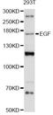 Epidermal Growth Factor antibody, LS-C747986, Lifespan Biosciences, Western Blot image 