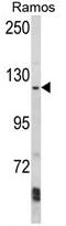 AP2 Associated Kinase 1 antibody, AP17859PU-N, Origene, Western Blot image 