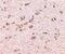 DLG Associated Protein 1 antibody, PA5-20531, Invitrogen Antibodies, Immunohistochemistry paraffin image 