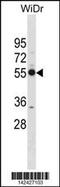 Proteasome 26S Subunit, Non-ATPase 12 antibody, 60-863, ProSci, Western Blot image 