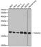 Transgelin 2 antibody, GTX33556, GeneTex, Western Blot image 