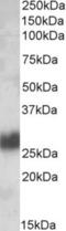 Thy-1 Cell Surface Antigen antibody, NBP1-51963, Novus Biologicals, Western Blot image 