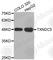 Thioredoxin Domain Containing 5 antibody, A3516, ABclonal Technology, Western Blot image 