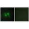 STEAP3 Metalloreductase antibody, A05568, Boster Biological Technology, Immunohistochemistry frozen image 