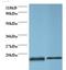 Profilin 1 antibody, LS-C211762, Lifespan Biosciences, Western Blot image 