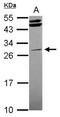Serine/Threonine Kinase 16 antibody, NBP2-20513, Novus Biologicals, Western Blot image 