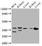 Pyrophosphatase (Inorganic) 2 antibody, CSB-PA867137LA01HU, Cusabio, Western Blot image 