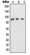Nucleoporin 88 antibody, orb214341, Biorbyt, Western Blot image 