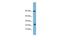 Heparin Binding EGF Like Growth Factor antibody, PA5-42703, Invitrogen Antibodies, Western Blot image 