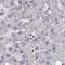 Beaded Filament Structural Protein 2 antibody, NBP2-57096, Novus Biologicals, Immunohistochemistry paraffin image 