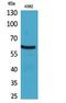 Cytochrome B-245 Beta Chain antibody, STJ96748, St John