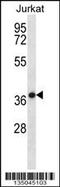 HSPA (Hsp70) Binding Protein 1 antibody, 57-976, ProSci, Western Blot image 