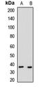 ADP-Ribosyltransferase 5 antibody, LS-C668909, Lifespan Biosciences, Western Blot image 