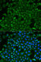 Cysteinyl-TRNA Synthetase antibody, LS-C748712, Lifespan Biosciences, Immunofluorescence image 
