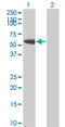 FYN Proto-Oncogene, Src Family Tyrosine Kinase antibody, LS-C197255, Lifespan Biosciences, Western Blot image 