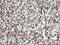 Cell Division Cycle 123 antibody, M08251, Boster Biological Technology, Immunohistochemistry paraffin image 