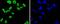 Far Upstream Element Binding Protein 1 antibody, A03126-1, Boster Biological Technology, Immunocytochemistry image 