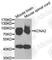 Potassium Voltage-Gated Channel Subfamily A Member 2 antibody, A6295, ABclonal Technology, Western Blot image 