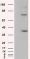 DExD-Box Helicase 39B antibody, MA5-25105, Invitrogen Antibodies, Western Blot image 