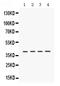 Casein Kinase 1 Alpha 1 antibody, PB9693, Boster Biological Technology, Western Blot image 