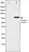BMX Non-Receptor Tyrosine Kinase antibody, orb106176, Biorbyt, Western Blot image 