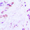 Activating Transcription Factor 2 antibody, LS-C353952, Lifespan Biosciences, Immunohistochemistry paraffin image 