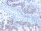 RB Transcriptional Corepressor 1 antibody, GTX02700, GeneTex, Immunohistochemistry paraffin image 