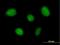 TNFAIP3 Interacting Protein 1 antibody, H00010318-B01P, Novus Biologicals, Immunocytochemistry image 