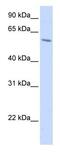 Probable protein-cysteine N-palmitoyltransferase porcupine antibody, ab105543, Abcam, Western Blot image 