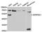 Serpin Family C Member 1 antibody, TA327084, Origene, Western Blot image 