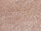 TANK Binding Kinase 1 antibody, GTX02815, GeneTex, Immunohistochemistry paraffin image 