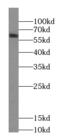 Coiled-coil domain-containing protein 86 antibody, FNab02133, FineTest, Western Blot image 