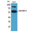 Carcinoembryonic Antigen Related Cell Adhesion Molecule 1 antibody, STJ96570, St John