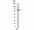 DEAD-Box Helicase 4 antibody, N1195-100UG, NSJ Bioreagents, Western Blot image 