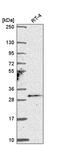 Testis Specific Serine Kinase 4 antibody, PA5-66343, Invitrogen Antibodies, Western Blot image 